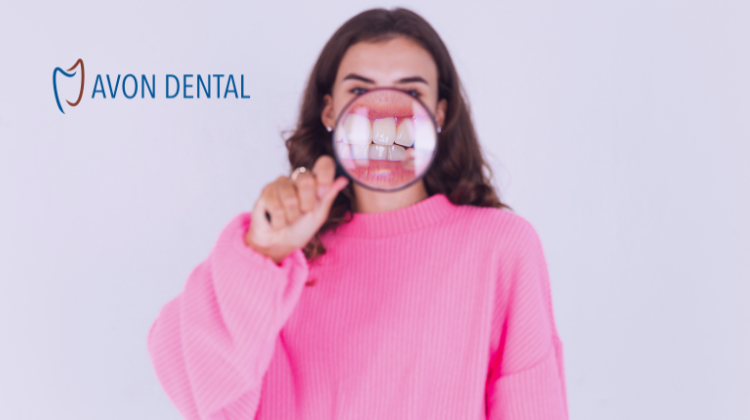 invisalign-vs-veneers-avon-oh