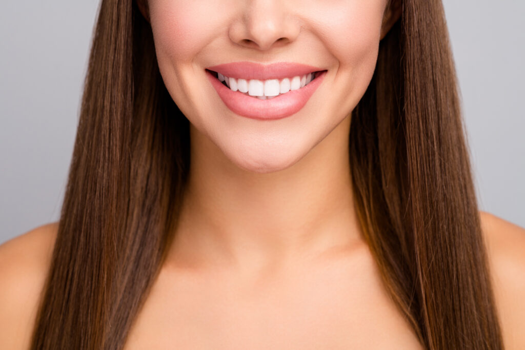 Porcelain Veneers